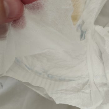 Molfix Bebek Bezlerinde Tela Sorunu Ve Rahatsızlık Yaşanması