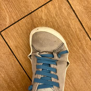 10 Günde Yırtılan Ayakkabı Ve Mağazadan İlgisizlik