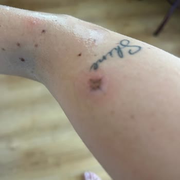 Aslı Geylani Nail Art İşlem Sonrasında Kollarımda Yanıklar Oluştu