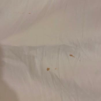 Otel Odasında Temizlik Yapılmadı Hijyen Ve Hizmet Büyük Hayal Kırıklığı Yaşattı