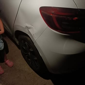 Otoparkta Aracımıza Verilen Zararın Karşılanmaması Ve Otel Sorumluluğunun Reddi