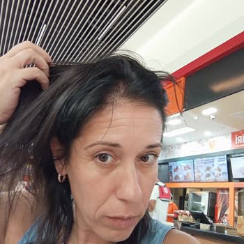 Saç Boyası Sonrası Beklenmedik Renk Ve Mağduriyet