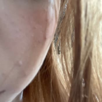 Paden Cosmetics Ürünü Kullandıktan Bir Gün Sonra Cildimde Alerji Ve Kabarcıklar Oluştu