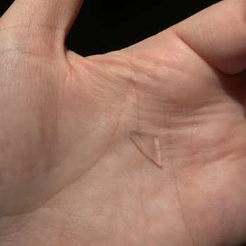 Külah Dondurmanın İçinden Çıkan Cam Parçası Bebeğimi Tehlikeye Attı