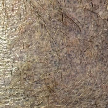 Saç Gölgelendirme Sonrası Renk Değişimi Ve Sürekli Hayal Kırıklığı