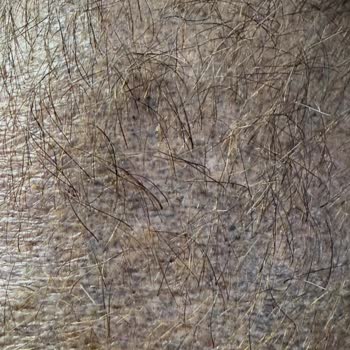 Saç Gölgelendirme Sonrası Renk Değişimi Ve Sürekli Hayal Kırıklığı