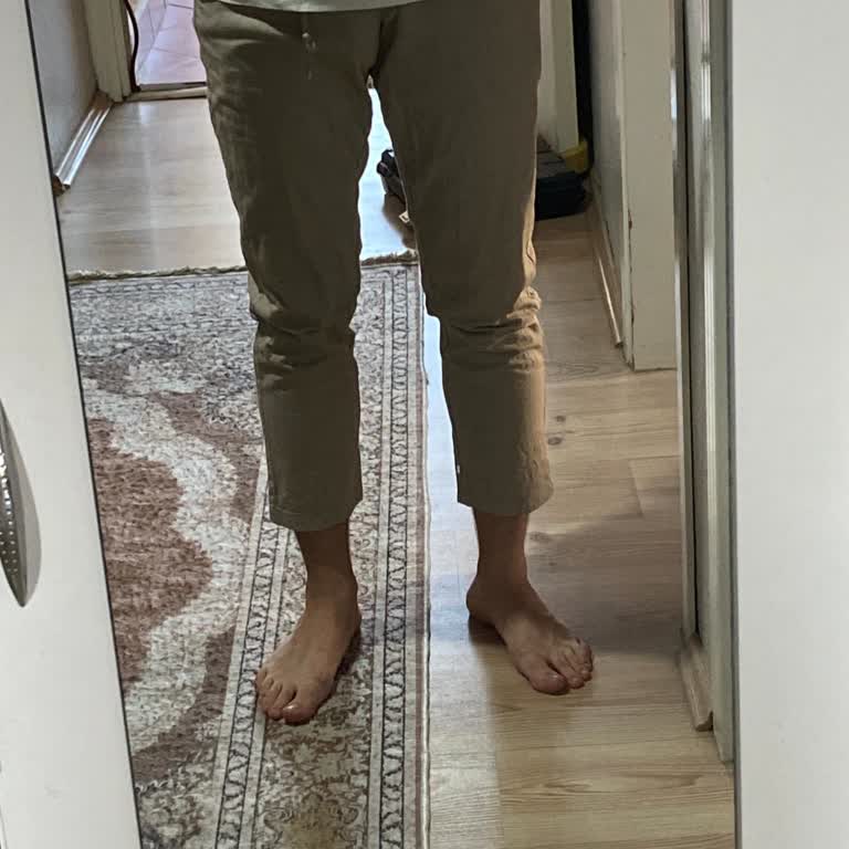 Garaj Günlerinden Alınan Pantolonun Çekmesi Ve Garanti Desteği Sorunu