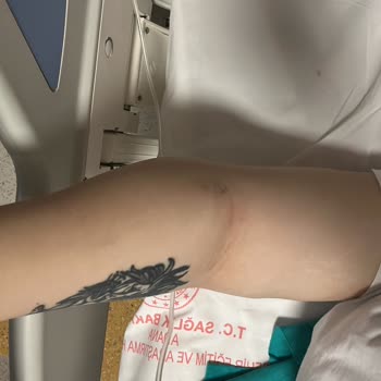 Adana Şehir Hastanesi Kadın Doğum Servisi'nde Kötü Muamele Ve İlgisizlik