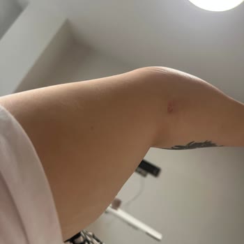 Adana Şehir Hastanesi Kadın Doğum Servisi'nde Kötü Muamele Ve İlgisizlik