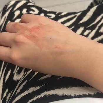 Adana Şehir Hastanesi Kadın Doğum Servisi'nde Kötü Muamele Ve İlgisizlik