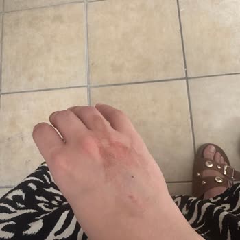 Adana Şehir Hastanesi Kadın Doğum Servisi'nde Kötü Muamele Ve İlgisizlik