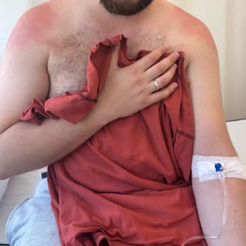 Lure Tüy Dökücü Krem Ciddi Bir Tahriş, Yoğun Ağrı, Kızarıklık Ve Yara Yaptı