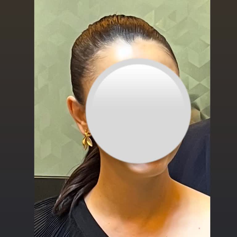 Basit Saç İşlemi İçin Ödenen Yüksek Ücret Şaşkınlığı