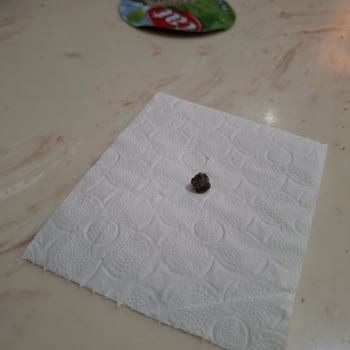 Konserve Barbunya İçinden Taş Parçası Çıkması