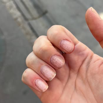 Hijyen Sorunu Ve Uzman Olmayan Personel Nedeniyle Sağlık Riski Yaşadım