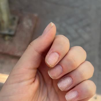 Hijyen Sorunu Ve Uzman Olmayan Personel Nedeniyle Sağlık Riski Yaşadım