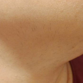 Sevim Alan Güzellik Merkezi Avcılar Şubesinden Şikayetçiyim