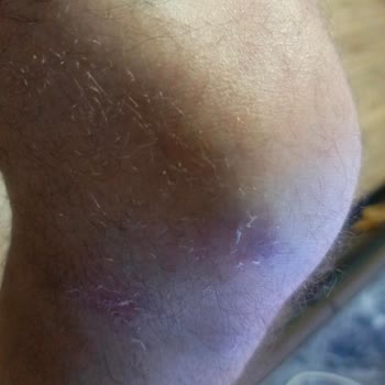 Emniyet Genel Müdürlüğü Bekçilerin Orantısız Müdahalesi ve Hak İhlali Sonrası Yaşadığımız Mağduriyet