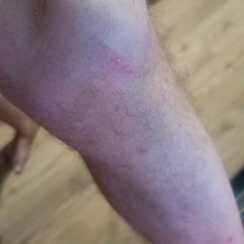 Emniyet Genel Müdürlüğü Bekçilerin Orantısız Müdahalesi ve Hak İhlali Sonrası Yaşadığımız Mağduriyet