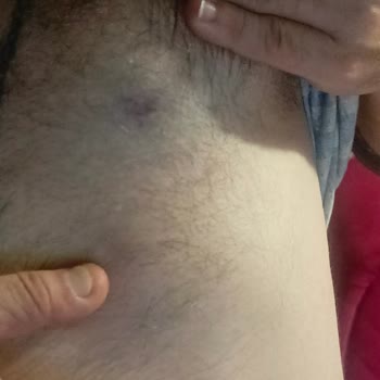 Emniyet Genel Müdürlüğü Bekçilerin Orantısız Müdahalesi ve Hak İhlali Sonrası Yaşadığımız Mağduriyet