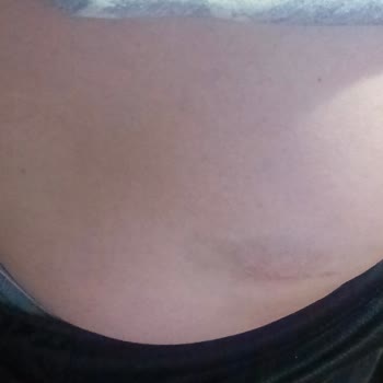 Emniyet Genel Müdürlüğü Bekçilerin Orantısız Müdahalesi ve Hak İhlali Sonrası Yaşadığımız Mağduriyet