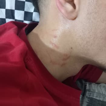 Emniyet Genel Müdürlüğü Ehliyetsiz Araç Kullanımı Sonrası Orantısız Polis Müdahalesi