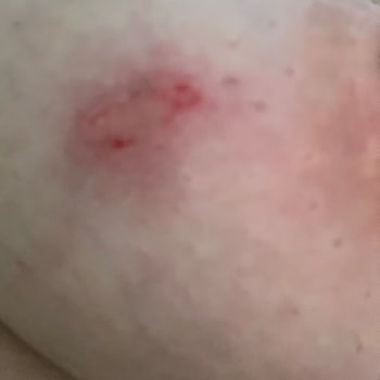 LCW Dream Mağazasında Sağlık Sorunu Ve Çalışan İlgisizliğiyle Mağduriyet Yaşadım