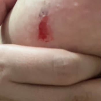 LCW Dream Mağazasında Sağlık Sorunu Ve Çalışan İlgisizliğiyle Mağduriyet Yaşadım