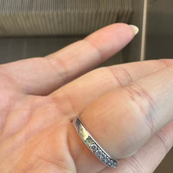 Alyans Yüzüğümde Tekrarlayan Taş Düşmesi Ve Ürün Değişimi Sorunu