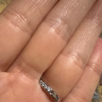 Alyans Yüzüğümde Tekrarlayan Taş Düşmesi Ve Ürün Değişimi Sorunu