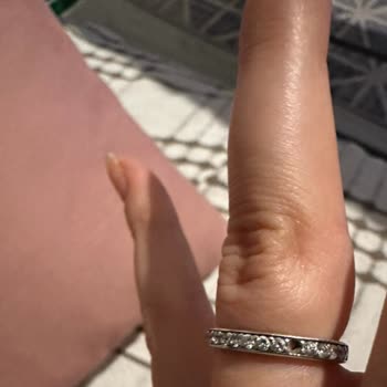 Alyans Yüzüğümde Tekrarlayan Taş Düşmesi Ve Ürün Değişimi Sorunu