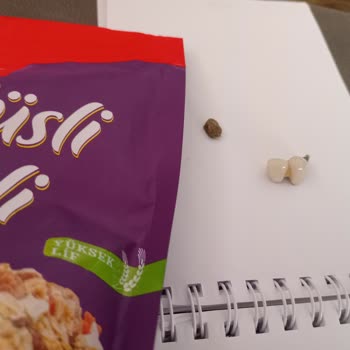 BİM'den Aldığım Müsli İçinden Taş Çıktı, Dişimi Kırdı: Sağlığım Tehlikeye Girdi Ve Mağduriyetim Giderilmiyor