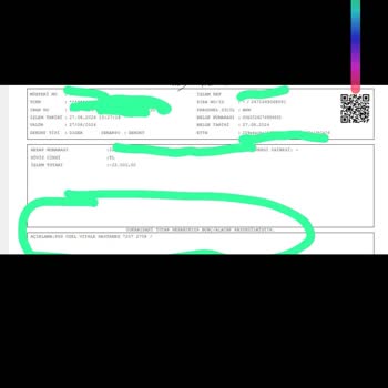 Hastaneden Doğum İşlemi Sonrası Fatura Alamıyorum