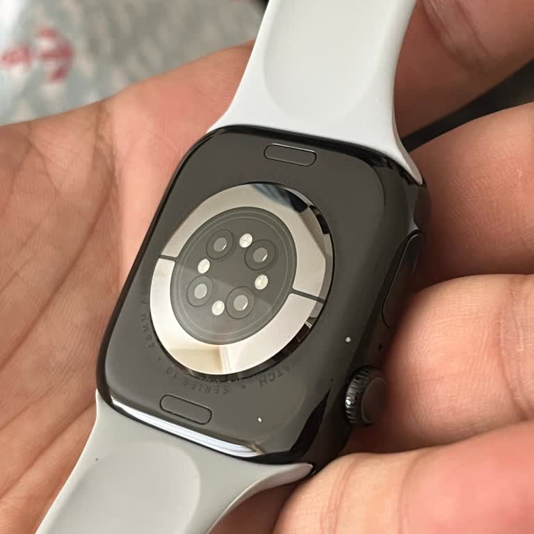 Garanti Servisinde Saatime Zarar Verildi, Sorunum Çözülmedi