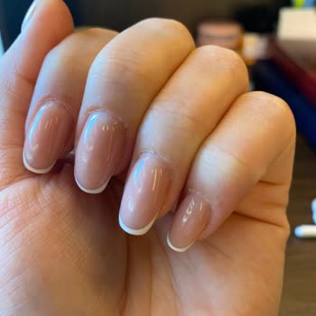 Hijyen Eksikliği Ve Özensiz İşlem Nedeniyle Sağlık Sorunu Yaşadım