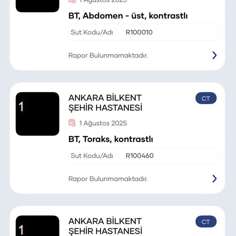 Tomografi Raporumun Gecikmesi Tedavimi Ve Psikolojimi Olumsuz Etkiliyor