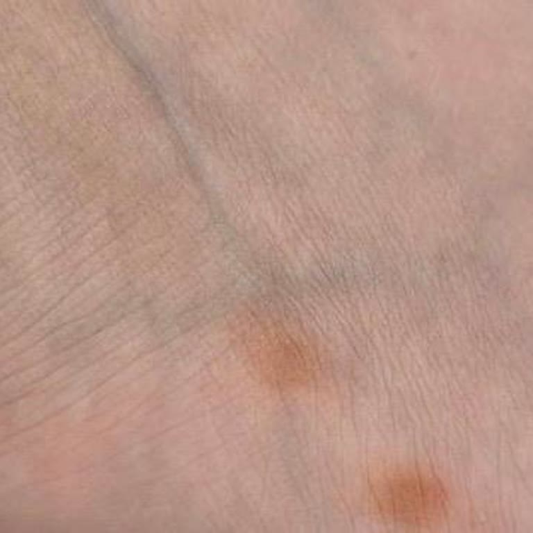 Hotiç Terlikte Pas Lekesi Ve Değişim Talebim Reddedildi