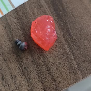 Şeker Paketinden Vida Çıktı, Dişim Kırıldı: Mağduriyetim Giderilmiyor