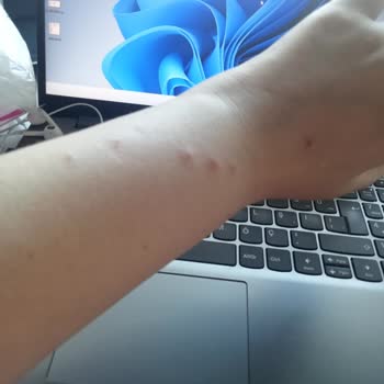 Fethiye Otelinde Böcek Sorunu Ve Ücret İadesi Talebi