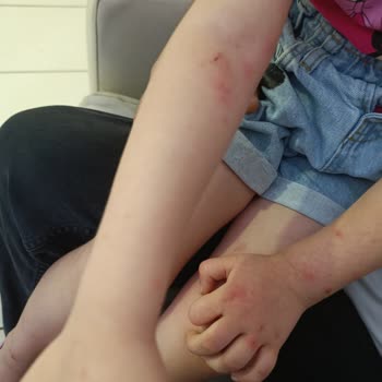 Aile Sosyal Hizmetler Bakanlığı Çocuğuma Gerekli Bakım Yapılmıyor