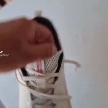 Skechers Ayakkabıdaki Deformasyon