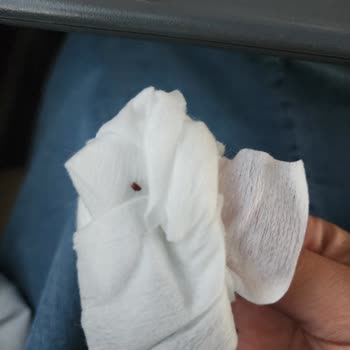 Otobüste Hijyen Eksikliği Ve Böcek Sorunu Nedeniyle İade Talebi