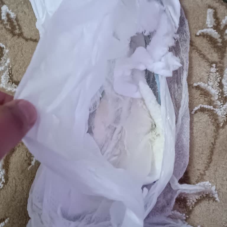 Molfix 4 Numara Külot Bezde Pişik Ve Dağılma Sorunu