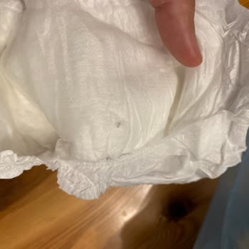 Bebek Bezinde Metal Kıymık Tehlikesiyle Karşılaştık