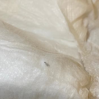 Bebek Bezinde Metal Kıymık Tehlikesiyle Karşılaştık