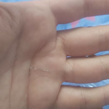 Aldığım Tatlıdan Metal Tel Çıkması Ve Müşteri Hizmetlerinden Yanıt Alamama