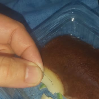 Aldığım Tatlıdan Metal Tel Çıkması Ve Müşteri Hizmetlerinden Yanıt Alamama