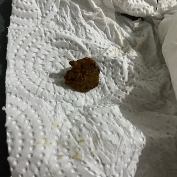 Çocuğumun Yediği Cipsin İçinden Sert Ve Yabancı Madde Çıktı