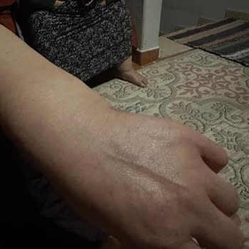 Acil Servis Personelinin Yetersiz Yardımı Ve İlgisiz Davranışı Mağduriyet Yarattı