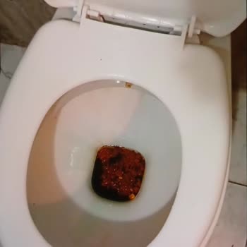 Otel Güvenliği Ve Hijyen Sorunları Tatilimizi Zehir Etti